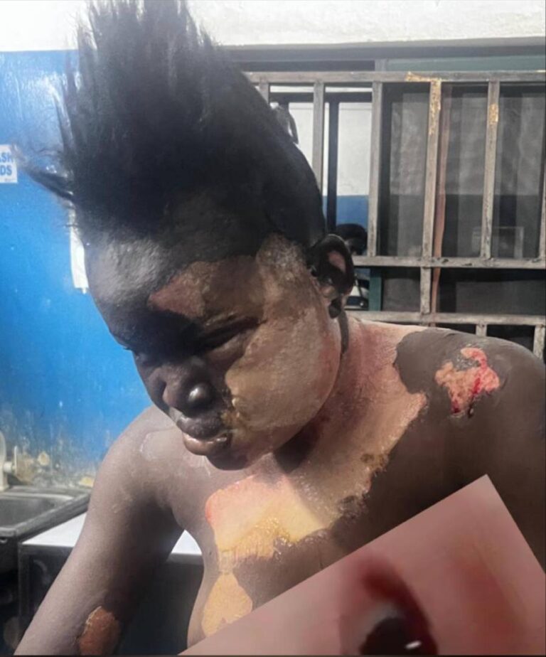 Deadly Jealousy: How Girlfriend Attacks Boyfriend’s Co-Worker With Hot Water In Kano WhatsApp Image 2025 11 18 at 10.28.36 AM